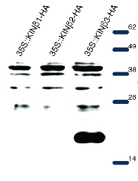AKINB3 | SNF1-related protein kinase regulatory subunit beta-3 in the group Antibodies Plant/Algal / Plant Developmental Biology / Plant Signal Transduction at Agrisera AB (Antibodies for research) (AS15 2859)